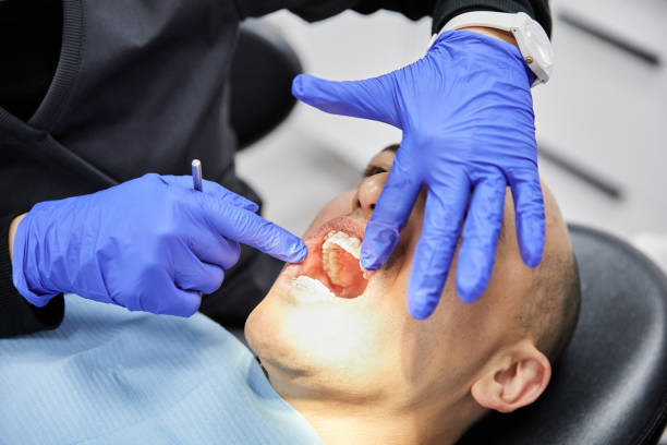 Best Emergency Treatment for Dental Infections or Abscesses in Winfield, TN